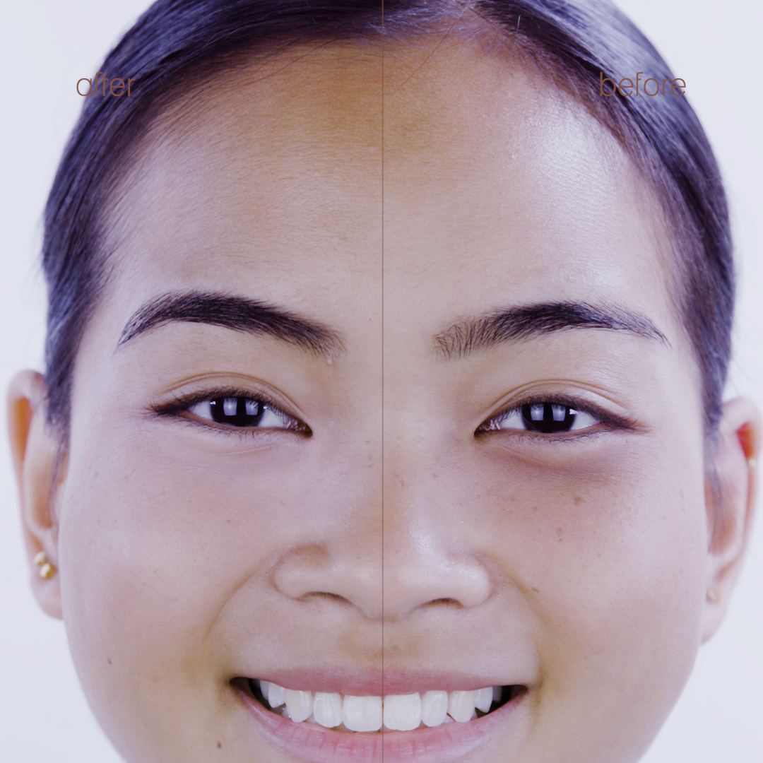 Correction Concentrate view 6 of 12